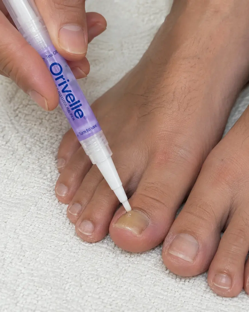Orivelle Anti Fungal Pen brush applicator held against a toenail