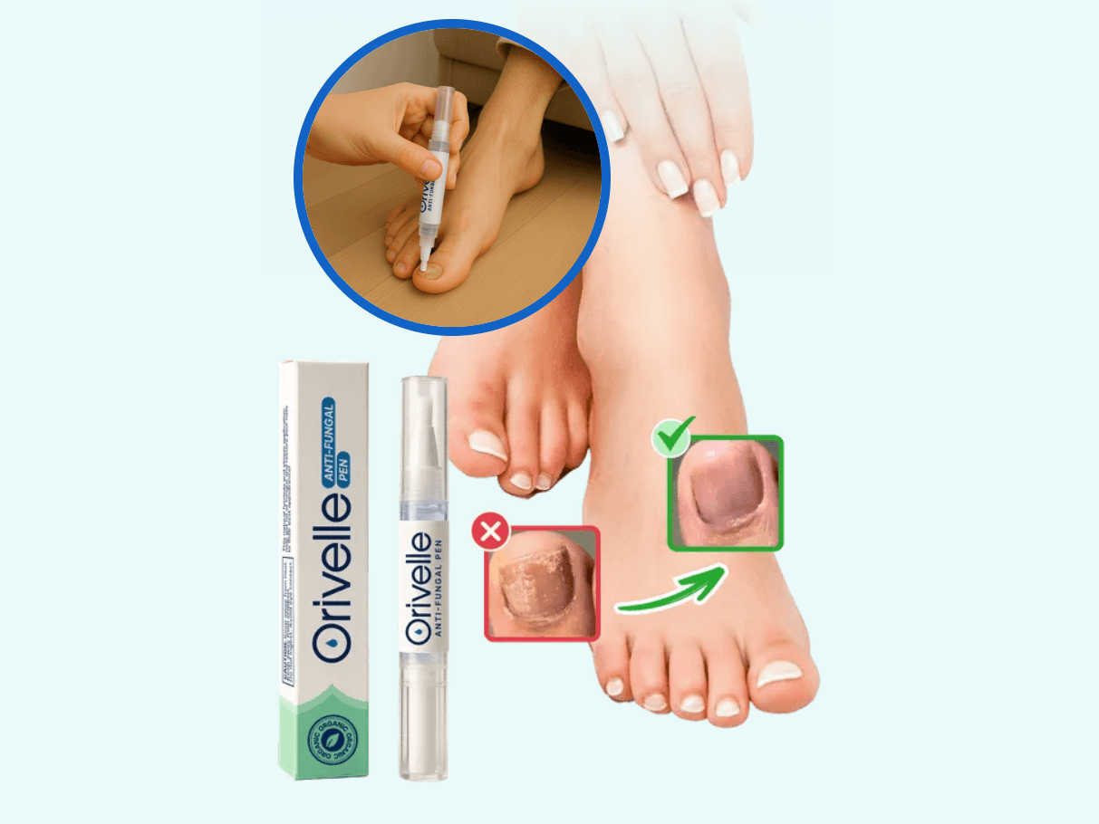 Orivelle Anti Fungal Pen product detail